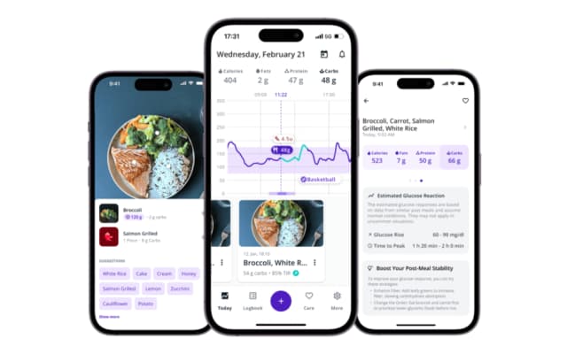AI-Powered Glucose Predictions
